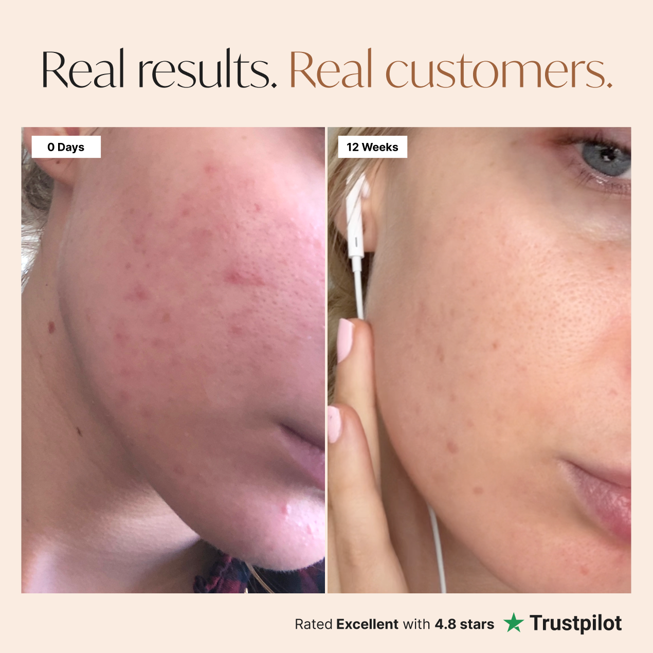 Liposomal Tripeptide Collagen